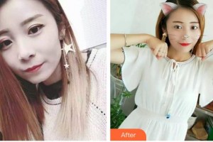 昆明藍(lán)橙口腔醫(yī)院王曉惠整形價(jià)格表附隱形托槽矯正案例展示