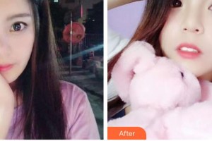 昆明醫(yī)科大學(xué)附屬口腔醫(yī)院億大口腔門診部華文整形價格表附牙齒隱形矯正案例展示