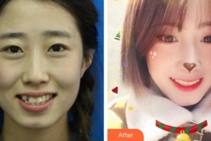 昆明醫(yī)科大學(xué)附屬口腔醫(yī)院億大口腔門診部和紅兵整形價(jià)格表附牙齒隱形矯正案例展示