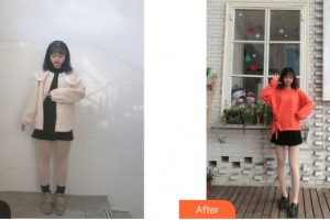 武漢華亞美容醫(yī)院龔衛(wèi)華整形價格表附大腿吸脂案例展示