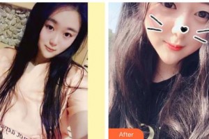 曲靖卓美口腔門診部李雪梅整形價格表附美白劑美白牙齒案例展示