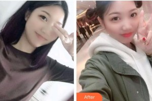 曲靖卓美口腔門診部陳吉林整形價格表附根管調(diào)節(jié)案例展示