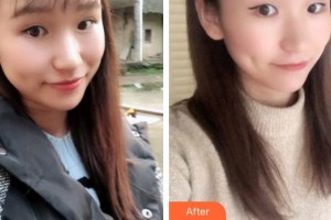 曲靖卓美口腔門診部李雪飄整形價格表附根管調(diào)節(jié)案例展示