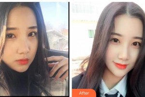 保山德康口腔醫(yī)院郭躍華整形價格表附金屬托槽矯正案例展示