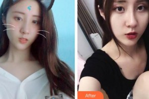 江蘇省人民醫(yī)院整形燒傷科周守貴整形價(jià)格表附激光祛斑案例展示