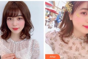 江蘇省第二中醫(yī)院眼科王煒整形價(jià)格表附眼部綜合案例展示