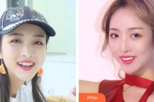 江蘇省口腔醫(yī)院章非敏整形價(jià)格表附牙齒隱形矯正案例展示