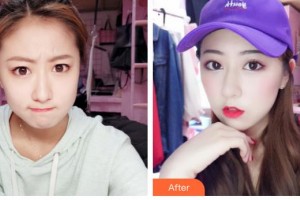 石家莊市中心醫(yī)院整形美容科趙亞平整形價格表附微針水光案例展示