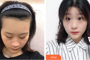 武漢百佳婦產(chǎn)醫(yī)院醫(yī)療美容科丁莉美整形價(jià)格表附植發(fā)案例展示