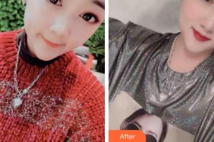 石家莊貴美人醫(yī)療美容醫(yī)院種冬至整形價格表附鼻部綜合案例展示