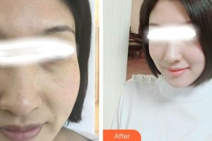 石家莊巍名仕醫(yī)療美容醫(yī)院高興柳整形價格表附美白嫩膚案例展示