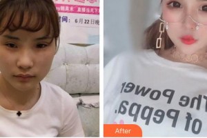 黑龍江藝星醫(yī)療美容醫(yī)院金晛珠整形價格表附鼻部綜合案例展示