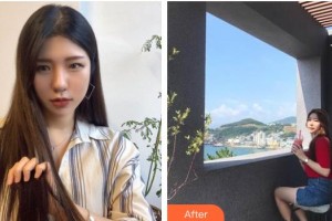 黑龍江省人民醫(yī)院整形美容中心高崧瀛整形價(jià)格表附鼻部綜合案例展示