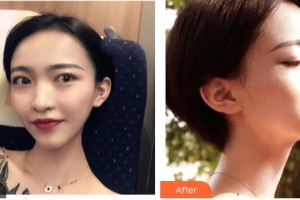 石家莊愛瑞爾醫(yī)療美容診所賈廣英整形價格表附光子嫩膚案例展示