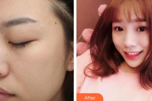 石家莊市婦產醫(yī)院醫(yī)療整形美容科齊立攀整形價格表附白瓷娃娃案例展示