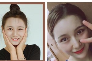 唐山萊美醫(yī)療美容醫(yī)院黃廣銅整形價格表附眼部綜合案例展示