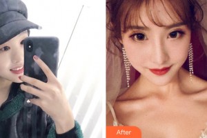 武漢佰視達眼科門診部陳軍整形價格表附眼部手術(shù)案例展示