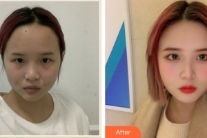 ?？诩t妝尚醫(yī)療美容門診部李杰整形價(jià)格表附皮膚美容案例展示