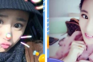 秦皇島二偉醫(yī)療美容診所王二偉整形價格表附眼部綜合案例展示