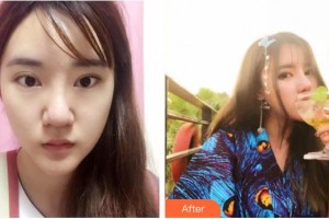 唐山冀東眼科醫(yī)院張?jiān)屏嵴蝺r(jià)格表附眼部綜合案例展示