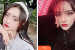 唐山冀東眼科醫(yī)院海整形價(jià)格表附開內(nèi)眼角案例展示