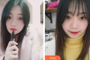 唐山牙博士口腔醫(yī)院韓亞春整形價(jià)格表附牙齒隱形矯正案例展示