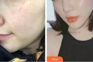 邯鄲都市整形美容醫(yī)院倪云志整形價(jià)格表附激光美膚激光案例展示