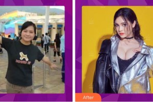 保定華美整形美容醫(yī)院胡慶旭整形價(jià)格表附假體隆胸案例展示