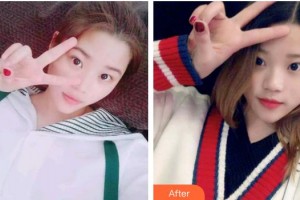 保定牙博士口腔醫(yī)院蘇帆整形價(jià)格表附冷光美白案例展示