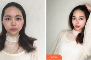 中山小欖人民醫(yī)院整形美容中心李國(guó)強(qiáng)整形價(jià)格表附眼部手術(shù)案例展示