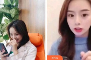 保定東陽口腔醫(yī)院張亞靜住院醫(yī)師整形價(jià)格表附超聲波潔牙案例展示