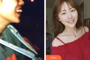 保定東陽口腔醫(yī)院馮春城整形價(jià)格表附隱形托槽矯正案例展示