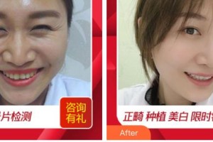 滄州楓華醫(yī)療美容診所魏光魁整形價(jià)格表附冷光美白案例展示
