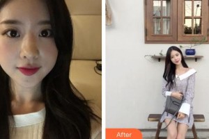 滄州奧拉克醫(yī)療美容醫(yī)院劉丹妞整形價(jià)格表附鼻部綜合案例展示