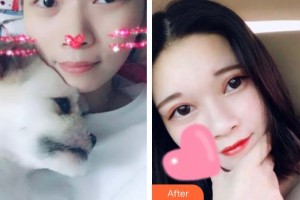 滄州眼科醫(yī)院李亞楠整形價格表附定點(diǎn)雙眼皮案例展示