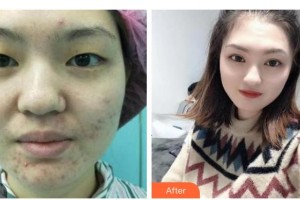 衡水愛爾眼科醫(yī)院韓賢奎整形價格表附眼部綜合案例展示