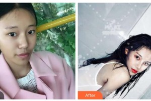 衡水尚美醫(yī)療美容門診部周林帥整形價格表附切開雙眼皮案例展示