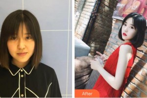 山西省整形外科醫(yī)院高振欣整形價格表附無針?biāo)獍咐故?>
</a>
<h3 class=