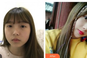 山西省眼科醫(yī)院高妍整形價格表附眼部綜合案例展示