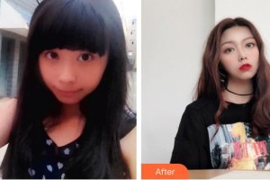 太原華美整形美容醫(yī)院邢藝濱整形價格表附熱拉提案例展示