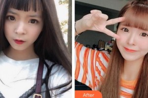 太原晉綺醫(yī)療美容診所朱晉綺整形價格表附激光美膚激光案例展示