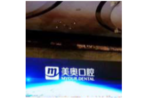 烏魯木齊牙科收費標準  烏魯木齊美奧口腔門診牙齒美白恢復圖