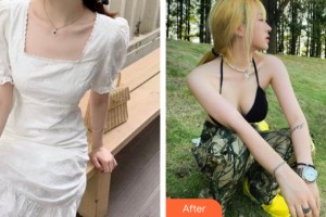 柳州華美整形美容醫(yī)院羅盛康整形價格表附隆胸手術(shù)案例展示