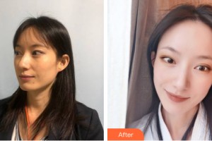 柳州麗人醫(yī)院整形美容科白承晚整形價格表附皮膚美容案例展示