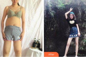 貴陽華美整形美容醫(yī)院田永華整形價(jià)格表附大腿吸脂案例展示