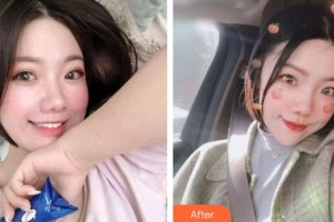 太原愛爾眼科醫(yī)院席海杰整形價(jià)格表附激光去黑眼圈案例展示