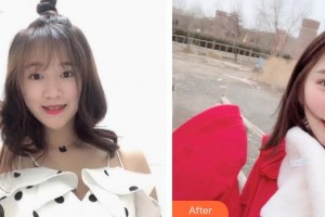 太原時光整形美容醫(yī)院王瑛主診醫(yī)師整形價格表附切開雙眼皮案例展示