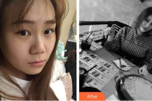 大同清美醫(yī)療美容診所孫化北整形價格表附激光美膚激光案例展示