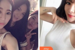 晉中鷹華眼科醫(yī)院張素平整形價格表附眼部綜合案例展示