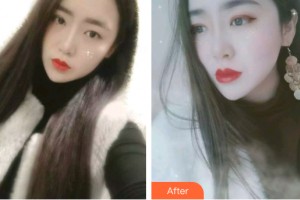 三亞口腔醫(yī)院吳年蕓整形價格表附牙齒矯正案例展示